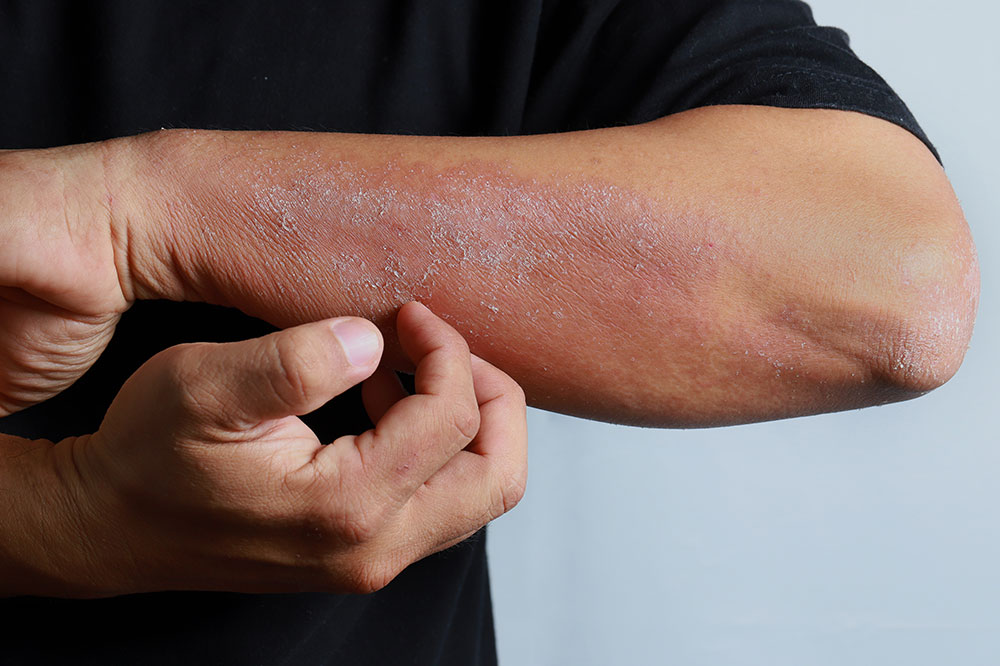 5 Urban Pollutants Known to Cause Skin Conditions