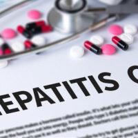 Busting 4 Myths About Hepatitis C