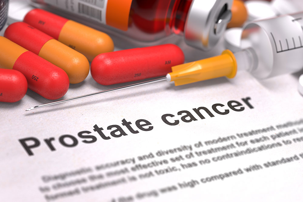 Prostate Cancer – Signs, Stages, and Types