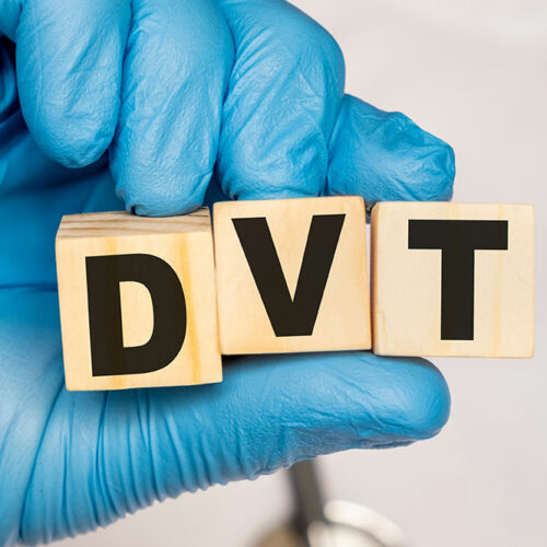 Risk Factors and Diagnosis Of DVT